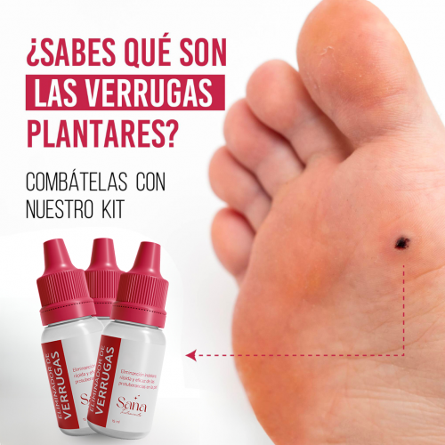 QUITA VERRUGAS