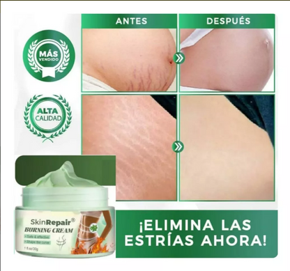 CREMA ANTIESTRÍAS SKINREPAIR