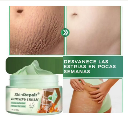 CREMA ANTIESTRÍAS SKINREPAIR