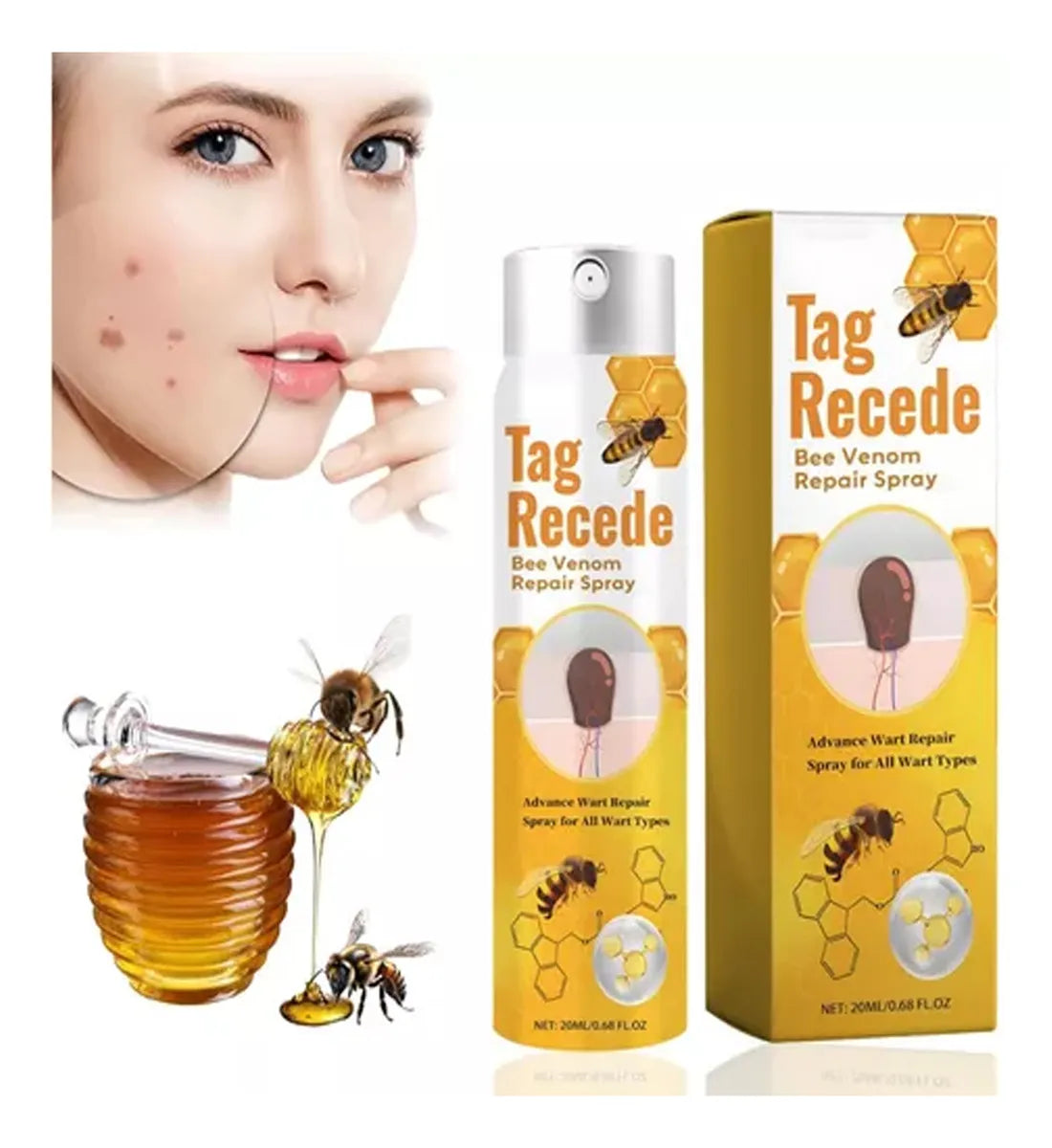 Spray Para Verrugas Con Veneno De Abeja