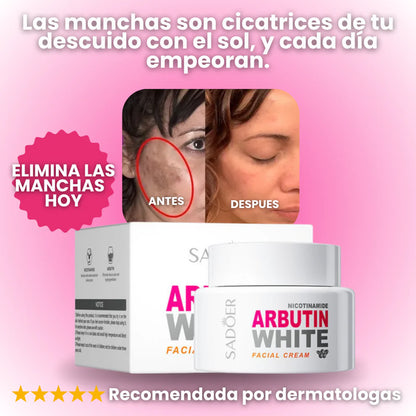 CREMA ACLARANTE ARBUTIN - QUITA MANCHAS